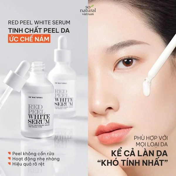 So'Natural Red Peel White - Tinh Chất Ức Chế Nám Dưỡng Trắng Da