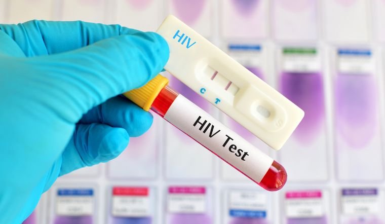 Bộ xét nghiệm HIV phát hiện sớm 21 ngày kết quả chính xác hơn 95% Alere HIV