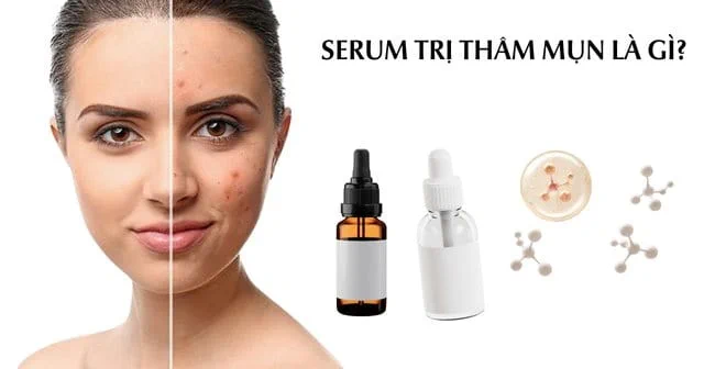 Serum giảm mụn thâm, mờ sẹo rỗ