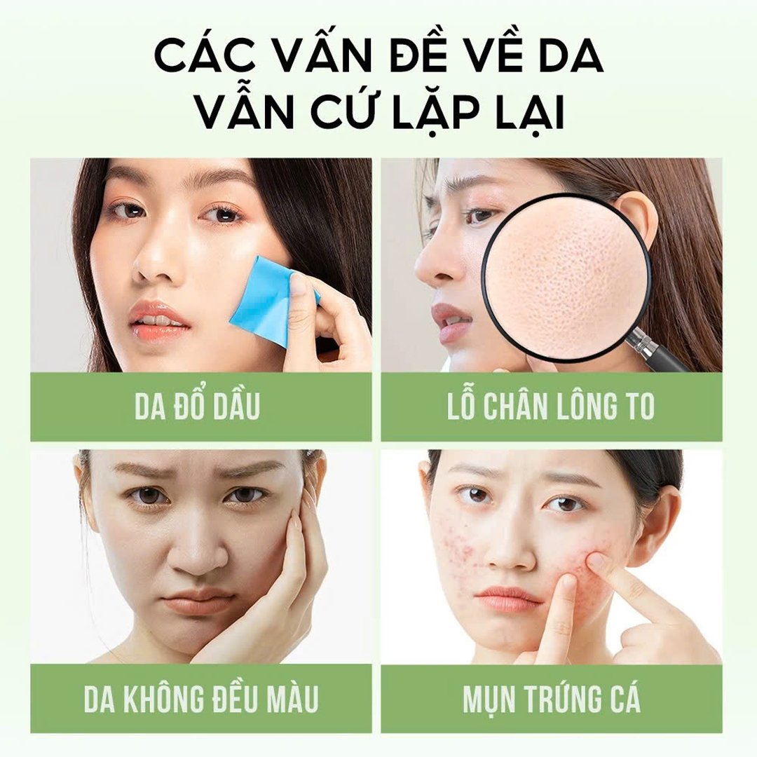 Combo 10 Mặt Nạ Colorkey Hỗ Trợ Giảm Dầu Mụn Từ Trà Xanh & BHA 25ml