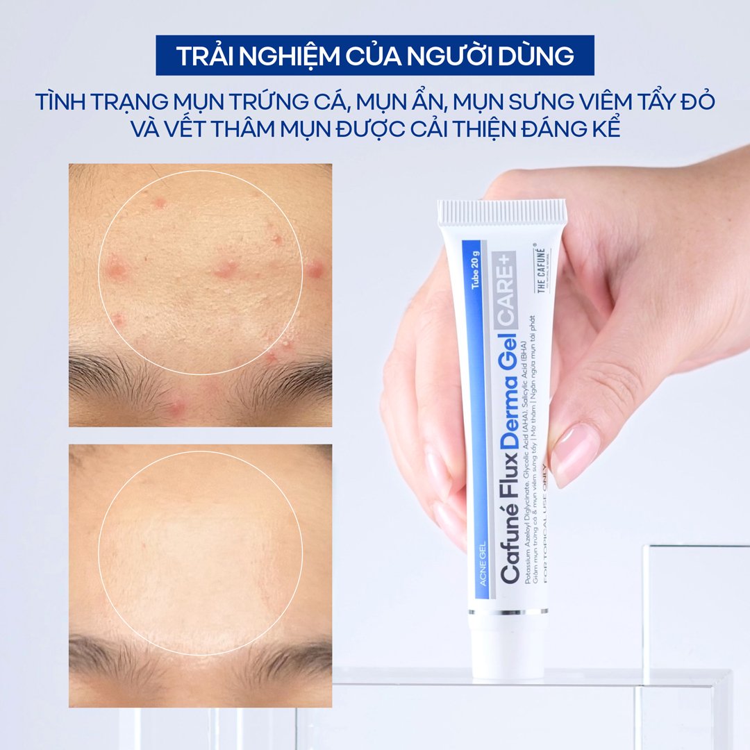 Gel Chấm Mụn The Cafuné Mờ Thâm 20g