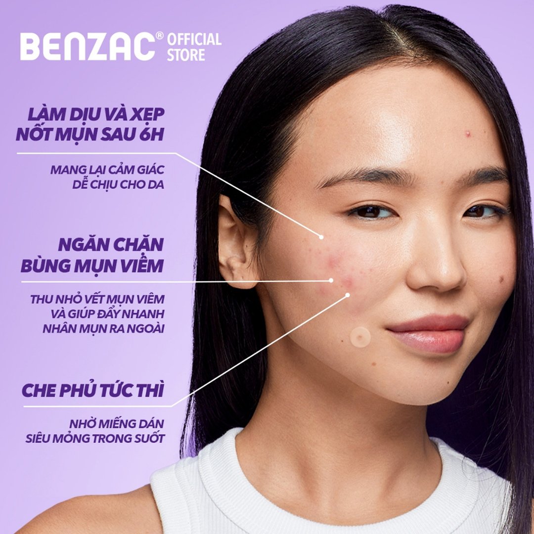 Miếng Dán Mụn Benzac Salicylic Acid 3 Trong 1 12 Miếng