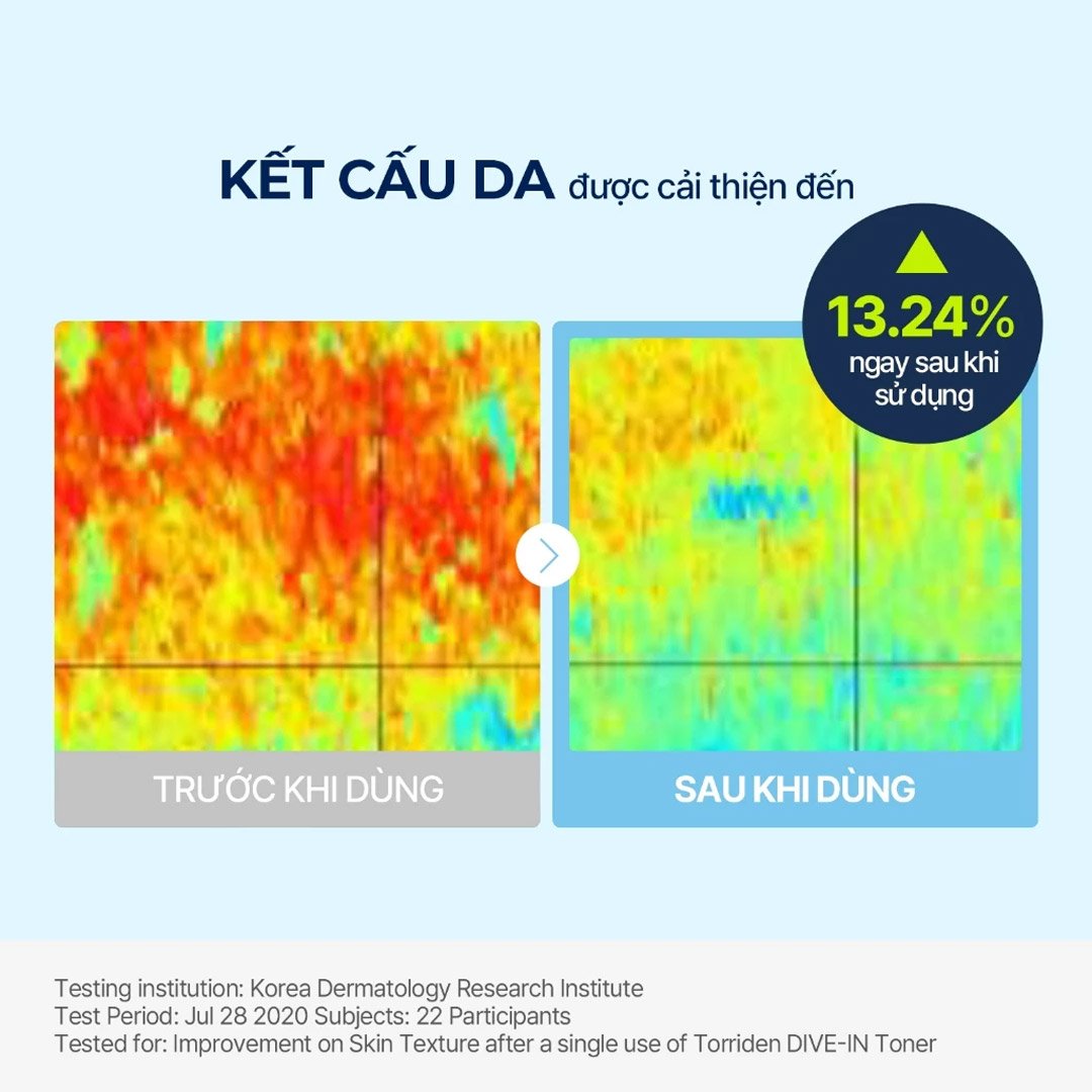 Toner Torriden Dưỡng Ẩm, Sáng Bóng Da 300ml