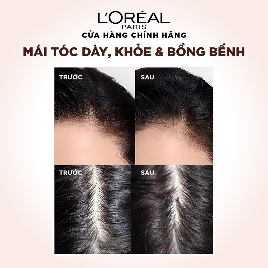 Dầu Xả L'Oreal Giảm Gãy Rụng Tóc Giúp Tóc Chắc Khỏe 440ml