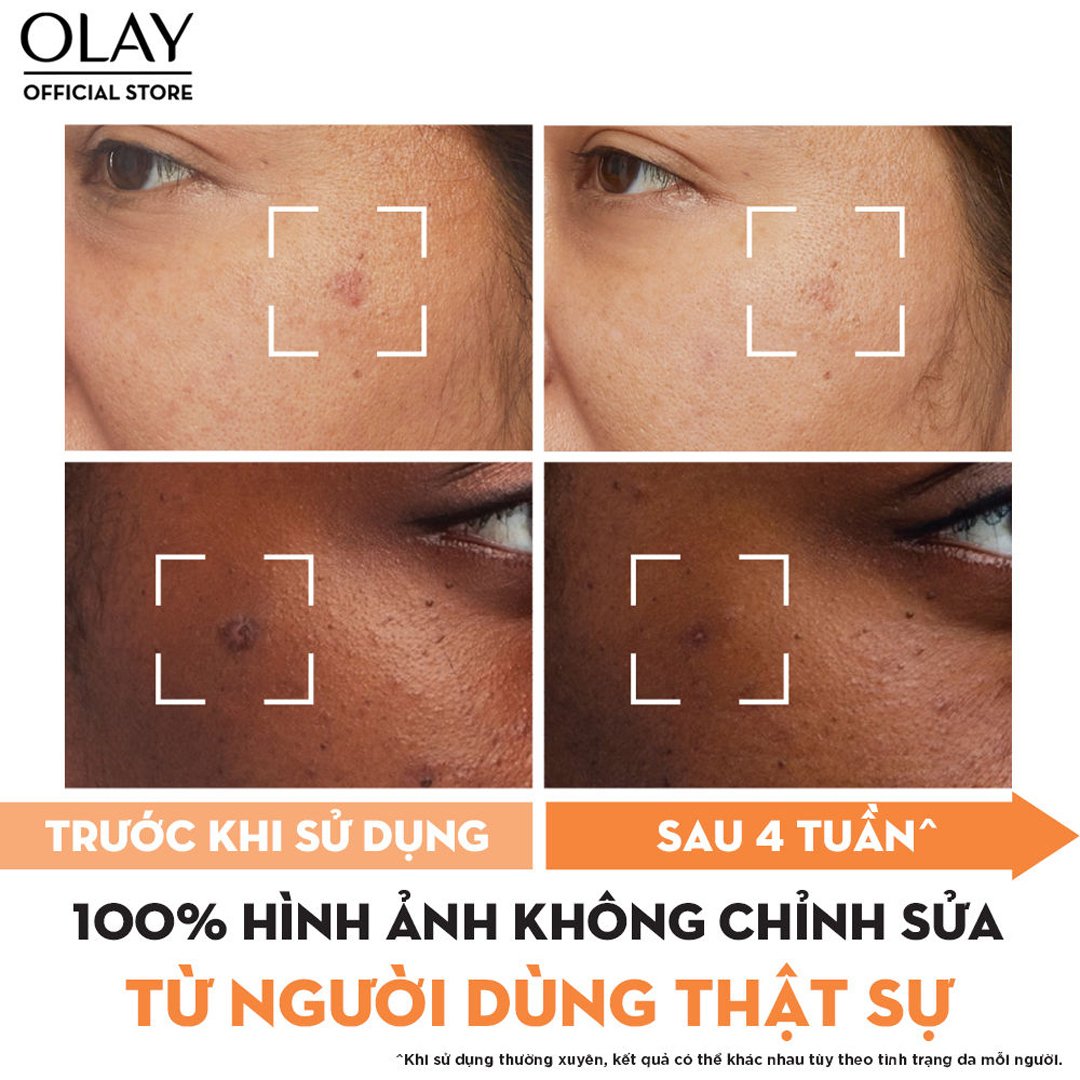 Serum Olay Mờ Vết Thâm, Đốm Nâu, Dưỡng Sáng Da 30ml