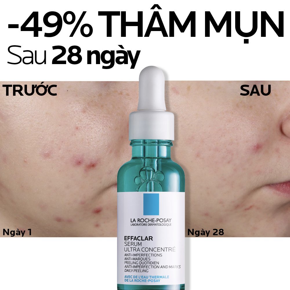 Serum La Roche-Posay Giảm Mụn 3 Tác Động 30ml