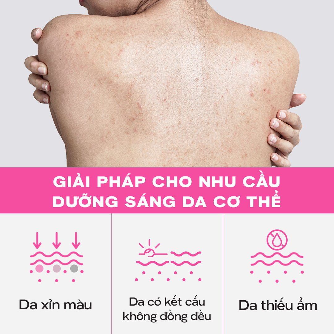 Serum Dưỡng Thể Skinoxy Dưỡng Sáng Đều Màu Da 275g