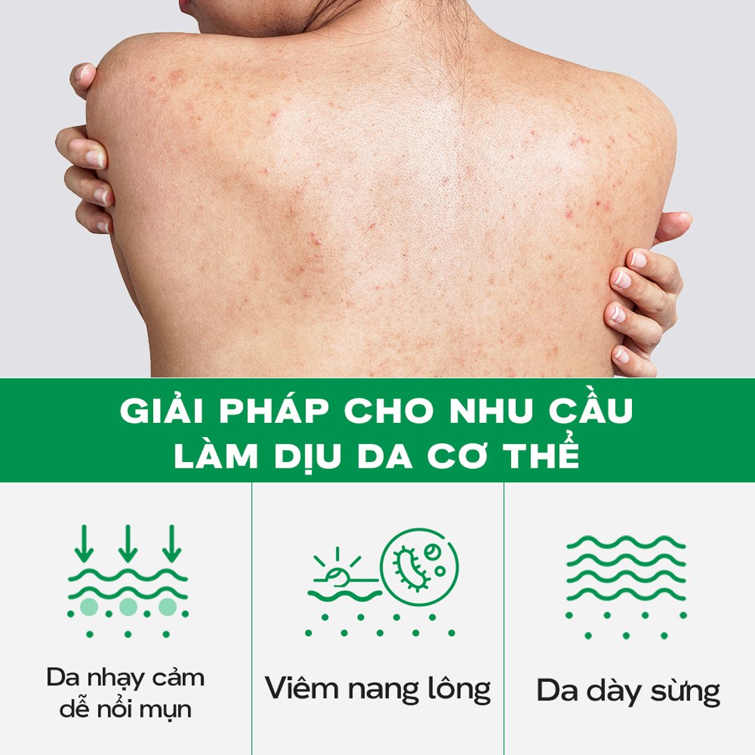 Serum Dưỡng Thể Skinoxy Sáng Da Và Mờ Đốm Sẫm Màu 275g